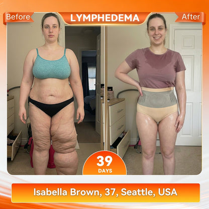 30%🎁🎁 𝑩𝑳𝑼𝐄𝙎𝙃𝙊𝙏® 🎗️ 𝟐𝟎𝟐𝟔 𝑴𝒐𝒓𝒊𝒏𝒈𝒂 & 𝑩𝒆𝒓𝒃𝒆𝒓𝒊𝒏𝒆 4-𝑰𝒏-1 𝑴𝒊𝒄𝒓𝒐-𝑷𝒂𝒓𝒕𝒊𝒄𝒍𝒆 𝑺𝒄𝒖𝒍𝒑𝒕𝒊𝒏𝒈 & 𝑭𝒂𝒕-𝑩𝒖𝒓𝒏 𝑺𝒉𝒐𝒓𝒕𝒔