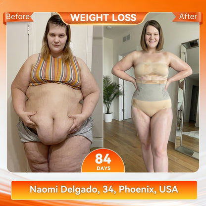 𝗙𝗹𝗮𝗴𝘀𝗵𝗶𝗽 𝗦𝘁𝗼𝗿𝗲 🎁 𝑩𝑳𝑼𝑬𝙎𝙃𝙊𝙏® 🎗️ 𝟐𝟎𝟐𝟔 𝑴𝒐𝒓𝒊𝒏𝒈𝒂 & 𝑩𝒆𝒓𝒃𝒆𝒓𝒊𝒏𝒆 4-𝑰𝒏-1 𝑴𝒊𝒄𝒓𝒐-𝑷𝒂𝒓𝒕𝒊𝒄𝒍𝒆 𝑺𝒄𝒖𝒍𝒑𝒕𝒊𝒏𝒈 & 𝑭𝒂𝒕-𝑩𝒖𝒓𝒏 𝑺𝒉𝒐𝒓𝒕𝒔