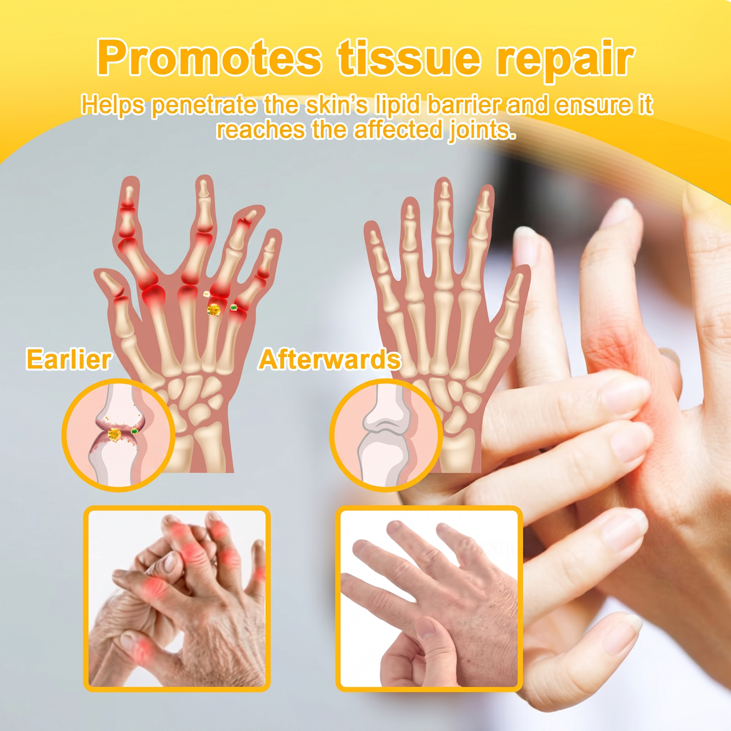 30% OFF 🎁🎁 | 𝐌𝐔𝐑𝐖𝐎𝐍® Bee Venom Balm for Pain Relief & Bone Healing ✨