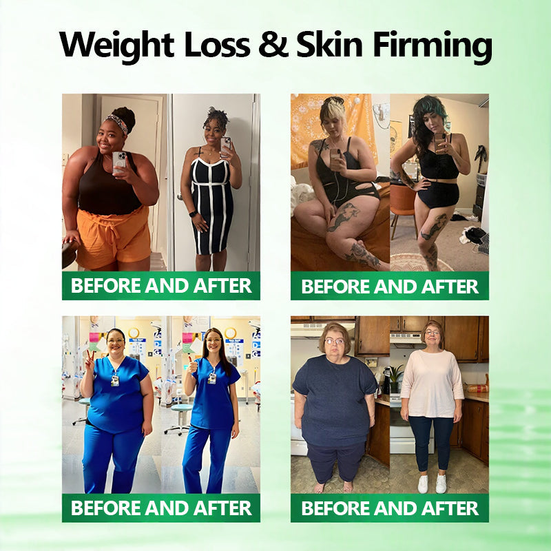 𝟳 𝗗𝗮𝘆𝘀 𝘁𝗼 𝗧𝗿𝗮𝗻𝘀𝗳𝗼𝗿𝗺𝗮𝘁𝗶𝗼𝗻! 👩‍⚕️| 𝑴𝑼𝑹𝑾𝑶𝑵® 𝑴-𝑩-𝑵 10-𝒊𝒏-1 𝑵𝒂𝒏𝒐 𝑭𝒖𝒔𝒊𝒐𝒏 𝑴𝒆𝒕𝒂𝒃𝒐𝒍𝒊𝒄 𝑷𝒂𝒕𝒄𝒉 👑| 𝐵𝑎𝑐𝑘𝑒𝑑 𝑏𝑦 𝑠𝑐𝑖𝑒𝑛𝑐𝑒 | 10-𝑖𝑛-1 𝑓𝑜𝑟𝑚𝑢𝑙𝑎 | 𝑅𝑒𝑠𝑢𝑙𝑡𝑠 𝑖𝑛 7 𝑑𝑎𝑦𝑠 💕